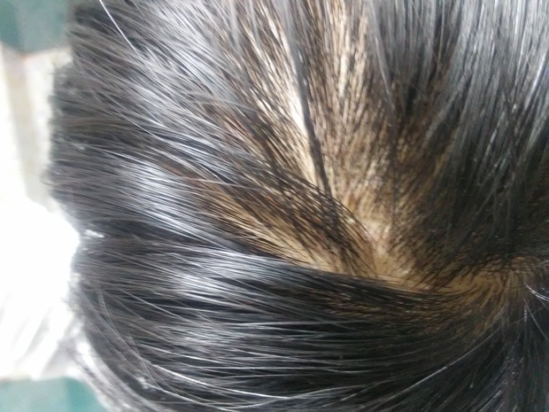 不知道为什么头顶的头发慢慢变少了,今年也才