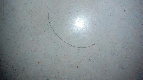 当一根头发从根部掉落,根部上会有一个小黄点